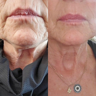 sonya river collagen